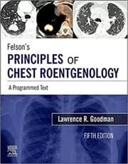 Felson's Principles of Chest Roentgenology